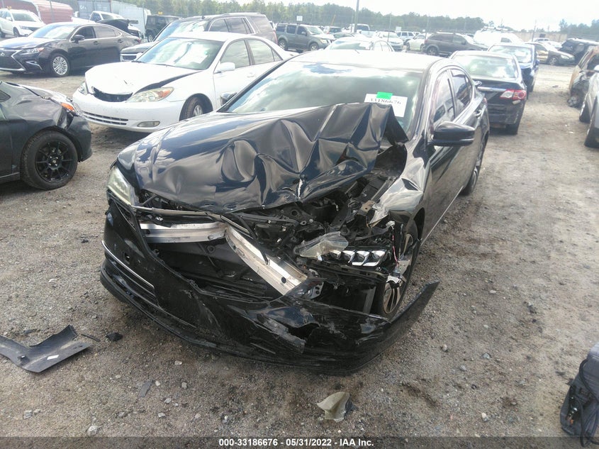 Acura Tlx 2016