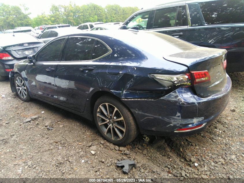 2017 ACURA TLX V6 W/TECHNOLOGY PKG - 19UUB2F5XHA004963