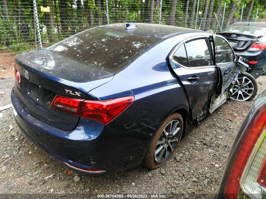 2017 ACURA TLX V6 W/TECHNOLOGY PKG - 19UUB2F5XHA004963