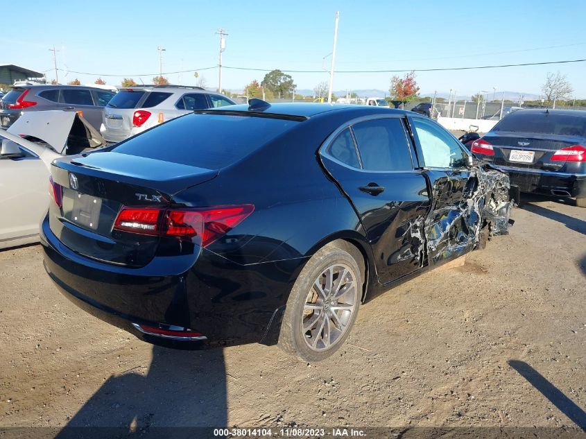 2015 ACURA TLX TECH - 19UUB2F5XFA004197