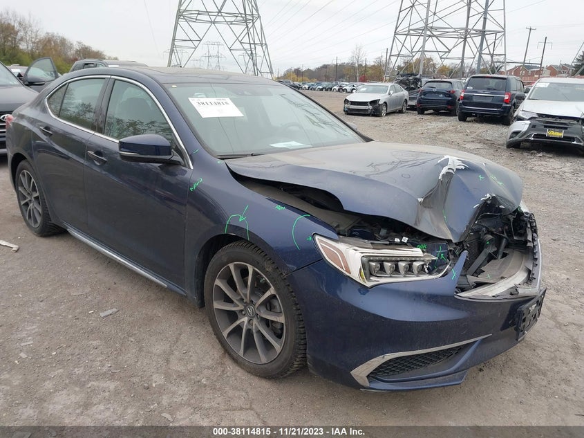 ACURA TLX TECH PKG 2018