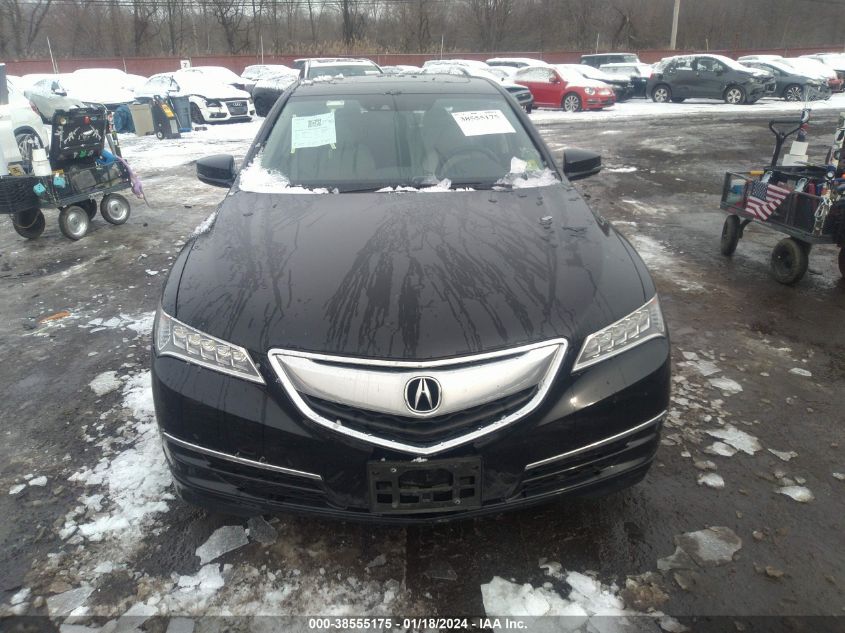 2017 ACURA TLX TECHNOLOGY PACKAGE - 19UUB1F53HA001994